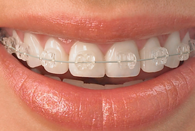 Aparelhos Estéticos