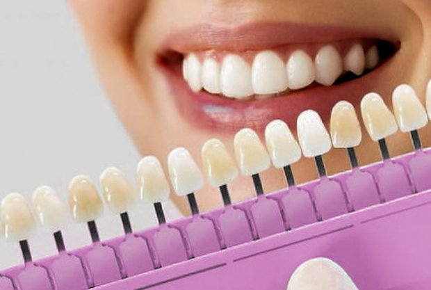 Antes e Depois do Clareamento