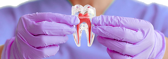 Equipamento de Endodontia