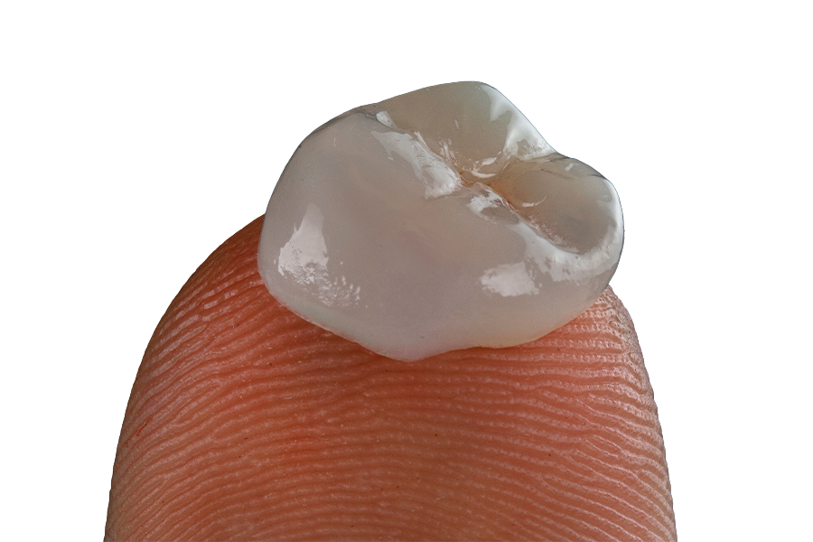 Coroas de Porcelana Pura