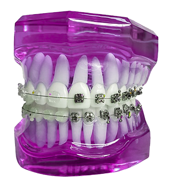 Ortodontia Estética