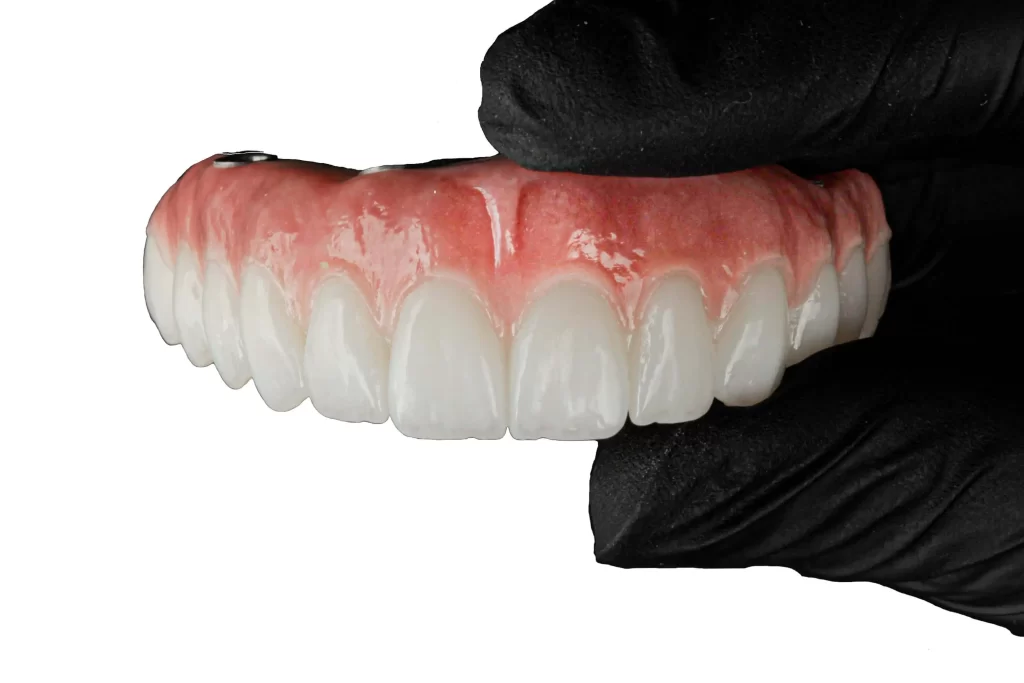 Benefícios Implante